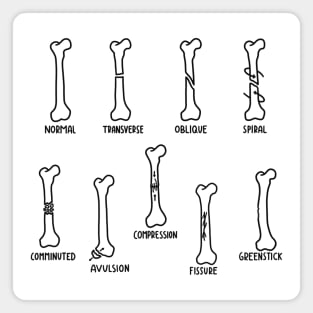 Hand Drawn Types of Fractures In Black Magnet